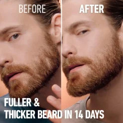 Online Beard Thickener Ansigtspleje|Ansigtspleje