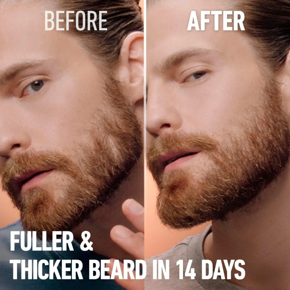 Online Beard Thickener Ansigtspleje|Ansigtspleje